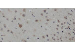 Immunohistochemistry of paraffin-embedded Mouse brain using IL4 Polyclonal Antibody at dilution of 1:50 (IL-4 Antikörper)