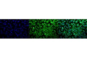 Immunocytochemistry/Immunofluorescence analysis using Rabbit Anti-p38 Polyclonal Antibody (ABIN361847 and ABIN361848). (MAPK14 Antikörper)