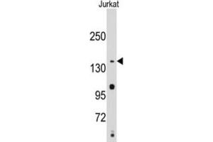 Western Blotting (WB) image for anti-Structural Maintenance of Chromosomes 2 (SMC2) antibody (ABIN2995231) (SMC2 Antikörper)