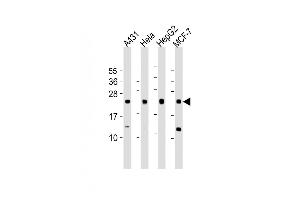 All lanes : Anti-LITAF Antibody (N-Term) at 1:1000 dilution Lane 1: A431 whole cell lysate Lane 2: Hela whole cell lysate Lane 3: HepG2 whole cell lysate Lane 4: MCF-7 whole cell lysate Lysates/proteins at 20 μg per lane. (LITAF Antikörper  (AA 31-60))