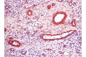 Image no. 1 for anti-Collagen, Type IV (COL4) antibody (ABIN481663) (Collagen IV Antikörper)