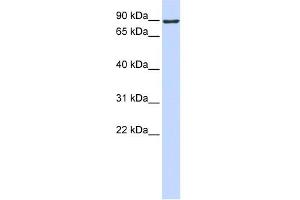 WB Suggested Anti-ATMIN Antibody Titration:  0.