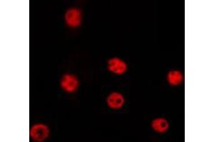 ABIN6268956 staining Hela by IF/ICC. (Cyclin D2 Antikörper  (C-Term))