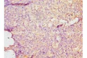 Immunohistochemistry of paraffin-embedded human tonsil tissue using ABIN7149695 at dilution of 1:100 (DMP1 Antikörper  (AA 254-513))