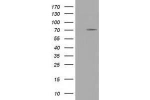 Western Blotting (WB) image for anti-Tripartite Motif Containing 2 (TRIM2) (AA 1-100), (AA 645-744) antibody (ABIN1490544)