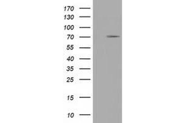 TRIM2 anticorps  (AA 1-100, AA 645-744)