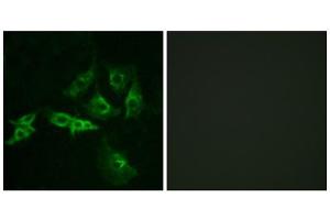 Immunofluorescence analysis of A549 cells, using GNRHR antibody. (GNRHR Antikörper  (Internal Region))