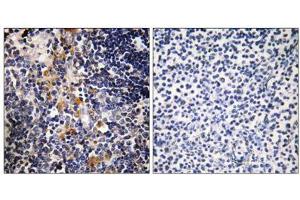 Immunohistochemistry analysis of paraffin-embedded human thymus gland tissue using MCPH1 antibody. (MCPH1 Antikörper  (N-Term))