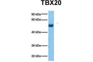 Host:  Rabbit  Target Name:  TBX20  Sample Tissue:  Human Lung Tumor  Antibody Dilution:  1. (TBX20 Antikörper  (Middle Region))