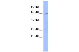 WB Suggested Anti-HRG Antibody Titration:  0. (HRG Antikörper  (Middle Region))