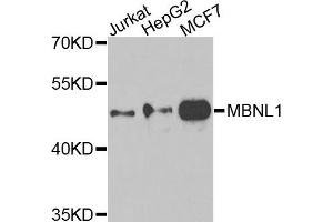Western blot analysis of extracts of various cells, using MBNL1 antibody. (MBNL1 Antikörper)