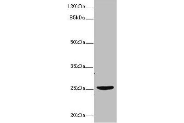 NEGR1 Antikörper  (AA 1-196)