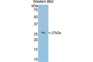 Detection of Recombinant IL2Rb, Mouse using Polyclonal Antibody to Interleukin 2 Receptor Beta (IL2Rb) (IL2 Receptor beta Antikörper  (AA 27-240))