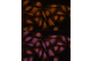 Immunofluorescence (IF) image for anti-Protein Phosphatase 2, Regulatory Subunit B', delta (PPP2R5D) (AA 450-550) antibody (ABIN7269690)