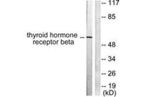 Western blot analysis of extracts from LOVO cells, using Thyroid Hormone Receptor beta Antibody.