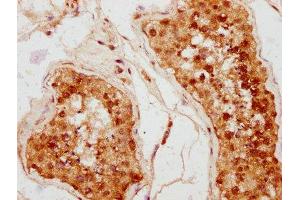 IHC image of ABIN7158634 diluted at 1:400 and staining in paraffin-embedded human testis tissue performed on a Leica BondTM system.
