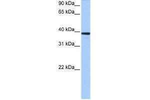 WB Suggested Anti-MRM1 Antibody Titration:  0. (MRM1 Antikörper  (C-Term))