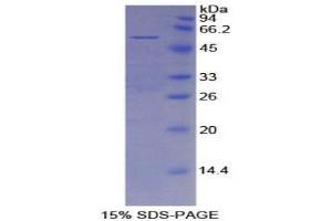 SDS-PAGE analysis of Mouse Mesothelin Protein.
