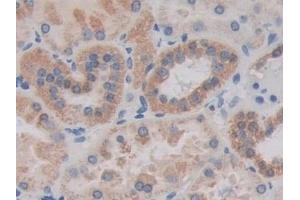Immunohistochemistry (IHC) image for anti-Mitogen-Activated Protein Kinase-Activated Protein Kinase 2 (MAPKAPK2) (AA 139-367) antibody (ABIN7441769)