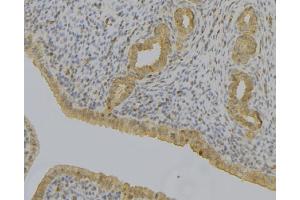 ABIN6279103 at 1/100 staining Human uterus tissue by IHC-P. (AKR1C1 Antikörper)