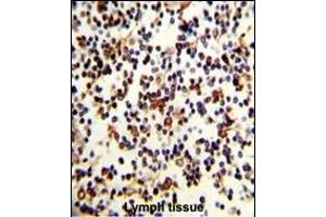 Immunohistochemistry (Paraffin-embedded Sections) (IHC (p)) image for anti-Complement Component (3d/Epstein Barr Virus) Receptor 2 (CR2) (AA 986-1014), (C-Term) antibody (ABIN390953)
