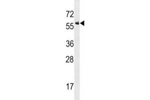 Western Blotting (WB) image for anti-Activin Receptor Type I (ACRV1) (AA 132-162) antibody (ABIN3029855)