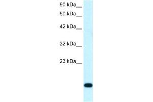 WB Suggested Anti-RPS16 Antibody Titration:  1. (RPS16 Antikörper  (N-Term))