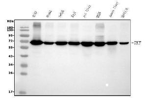 Western blot analysis of Transketolase/TKT using anti-Transketolase/TKT antibody (ABIN7598958). (TKT Antikörper  (AA 1-116))