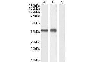 ABIN185571 (2µg/ml) staining of Jurkat (A), MOLT4 (B) and negative control A431 (C) cell lysate (35µg protein in RIPA buffer). (TIM3 Antikörper  (Internal Region))