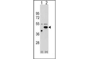Western blot analysis of ETNK2 (arrow) using ETNK2 Antibody (N-term) Cat. (Ethanolamine Kinase 2 Antikörper  (N-Term))