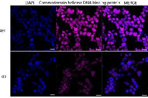 Immunocytochemical staining of HeLa cells using Chromodomain helicase DNA binding protein 3 antibody (ABIN7798069), 1:1,000), Top panel: wild-type (WT), Bottom panal: Chromodomain helicase DNA binding protein 3 shRNA knockdown (KD). (Rekombinanter CHD3 Antikörper)