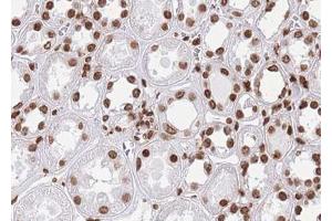 ABIN6268808 at 1/100 staining human kidney tissue sections by IHC-P. (HNRNPL Antikörper  (N-Term))