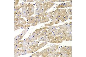 Immunohistochemistry of paraffin-embedded Rat heart using FIS1 antibody at dilution of 1:100 (x400 lens). (Fission 1 Antikörper)