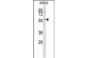 KRT6A Antibody (N-term) (ABIN1539042 and ABIN2848629) western blot analysis in K562 cell line lysates (35 μg/lane).