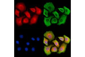 ABIN7093145 and ABIN7101263 staining HepG2 cells by IF/ICC. (Vitamin D-Binding Protein Antikörper  (Internal Region))