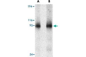 Western blot analysis of CD180 in human spleen tissue lysate with CD180 polyclonal antibody  at (A) 0.