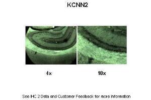 KCNN2 Antikörper  (C-Term)