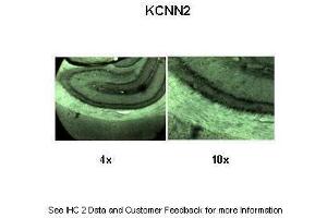 KCNN2 antibody  (C-Term)
