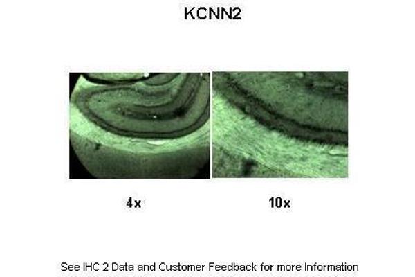 KCNN2 Antikörper  (C-Term)