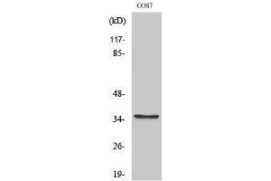 Western Blotting (WB) image for anti-Post-GPI Attachment To Proteins 1 (PGAP1) (Internal Region) antibody (ABIN3174074) (PGAP1 Antikörper  (Internal Region))