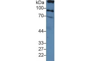 Detection of ITIH2 in Human Serum using Polyclonal Antibody to Inter Alpha-Globulin Inhibitor H2 (ITIH2)