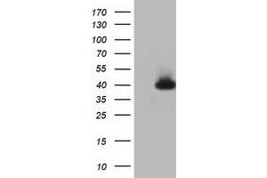 HEK293T cells were transfected with the pCMV6-ENTRY control (Left lane) or pCMV6-ENTRY HIBCH (Right lane) cDNA for 48 hrs and lysed. (HIBCH Antikörper)