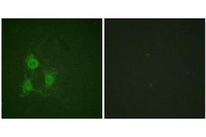 Immunofluorescence staining of methanol-fixed A549 cells using PKA α/β CAT (Phospho-Thr197) Antibody. (PRKACA Antikörper  (pThr197))