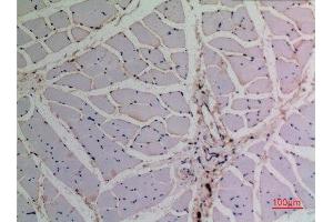 Immunohistochemistry (IHC) analysis of paraffin-embedded Rat Muscle, antibody was diluted at 1:100. (TCP1 alpha/CCTA Antikörper  (N-Term))