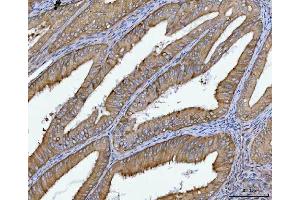 IHC analysis of SPATA18 using anti-SPATA18 antibody (ABIN7601020). (SPATA18 Antikörper  (AA 27-490))