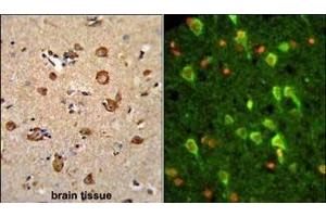 (LEFT)Formalin-fixed and paraffin-embedded human brain tissue reacted with ANXA7 Antibody (Center), which was peroxidase-conjugated to the secondary antibody, followed by DAB staining. (Annexin VII Antikörper  (AA 329-356))