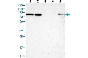 Western blot analysis of Lane 1: RT-4, Lane 2: U-251 MG, Lane 3: Human Plasma, Lane 4: Liver, Lane 5: Tonsil with HCFC2 polyclonal antibody  at 1:250-1:500 dilution. (HCFC2 Antikörper)