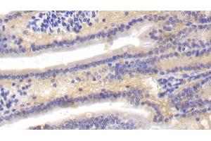 Immunohistochemistry (IHC) image for anti-Complement Component C4b (C4b) (AA 126-366) antibody (ABIN7433423)