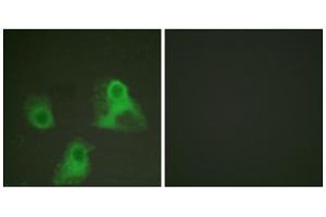 Immunofluorescence analysis of HeLa cells, using ADD1 (phospho-Ser726) antibody (ABIN5975885). (alpha Adducin Antikörper  (pSer726))