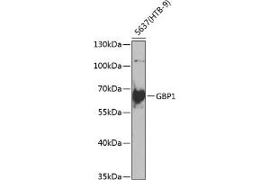 Western blot analysis of extracts of 5637(HTB-9) cells, using GBP1 antibody (ABIN6131996, ABIN6140998, ABIN6140999 and ABIN6222645) at 1:1000 dilution. (GBP1 Antikörper  (AA 383-592))